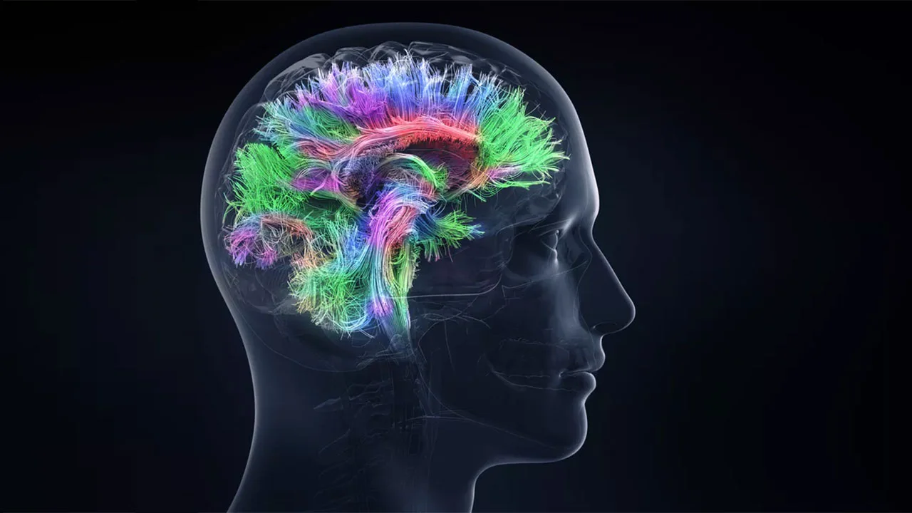 Meningioma MRI Findings